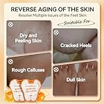 LANBENA Vitamin C Foot Peeling Mask, Foot Mask for Dry Cracked Feet, Exfoliator Peel Off Calluses Dead Skin Callus Remover, Repair Rough Heels & Get a Baby Soft Feet for Men and Women(2 Pairs) - Image 3