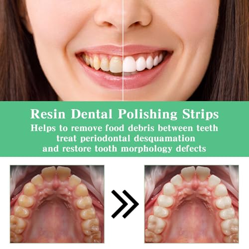 Image of 2Pcs Dental Polishing Strips Tooth File Oral Care Polisher Dental Tape Floss Fine Teeth Cleaning Sandpaper Teeth Sanding Grinding Tool for Deep Abrasive Finishing Health Women Man