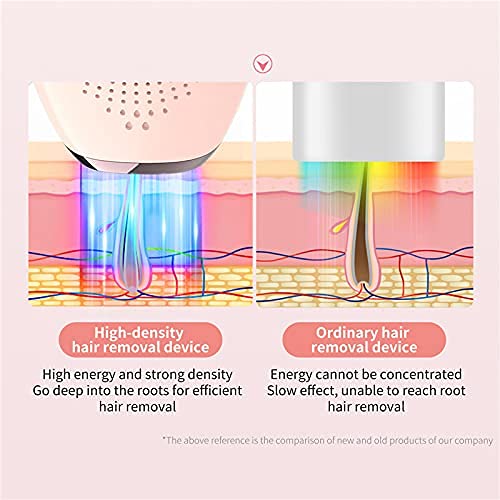 Miniatura 5 de Iborria IPL - Depilación láser permanente sin dolor para mujeres y hombres, actualización a 999,999 destellos para piernas faciales, brazos, axilas,