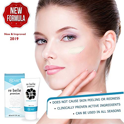 neck pigmentation cream