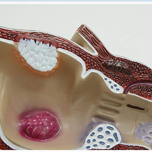 Modele medyczne patologiczny z trądzikiem anorektalnym, medyczny nauczanie patologii anorektalnej, materiał PCW, nauczanie medyczne Modele medyczne anatomiczny jelit