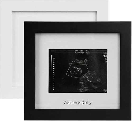 Miniatura 13 de IHEIPYE Marco de fotos de ecografía para bebé, marco de fotos de ultrasonido para futuros padres, baby showers, fiestas de revelación de género