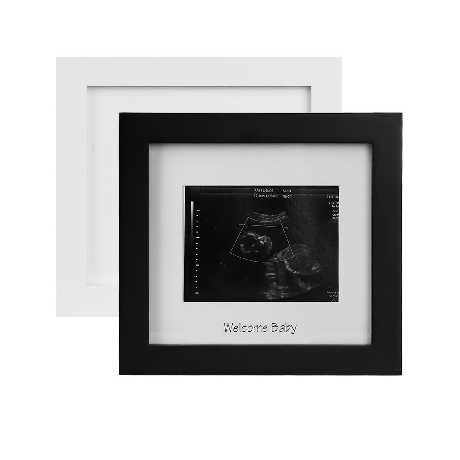 Cadre photo échographie bébé cadeau fête révélation du sexe