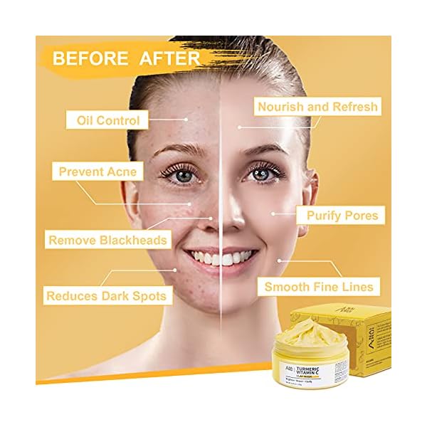 ANAIRUI-Turmeric-Vitamin-C-Clay-Mask-for-Acne-and-Dark-Spots-Vitamin-C-E-Clay-Facial-Mask-for-Blackheads-Pores-Wrinkles-Fine-Lines-Hydrating-Clarifying-Cleansing-Skincare-Mask-423-OZ ANAI RUI Turmeric Vitamin C Clay Mask, Vitamin C Clay Facial Mask for Blackheads, Pores, Wrinkles, Fine Lines, Hydrating, Clarifying, Cleansing, 4.23 OZ