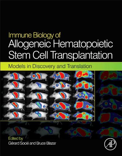 Immune Biology of Allogeneic Hematopoietic Stem Cell Transplantation ...