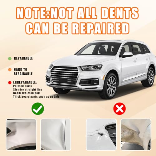 Image of Dent Puller,Powerful Car Dent Puller,Powerful Suction Dent Removal Kit for Cars,with Mini and Big,Dent Remover Tool for Car Dent Repair