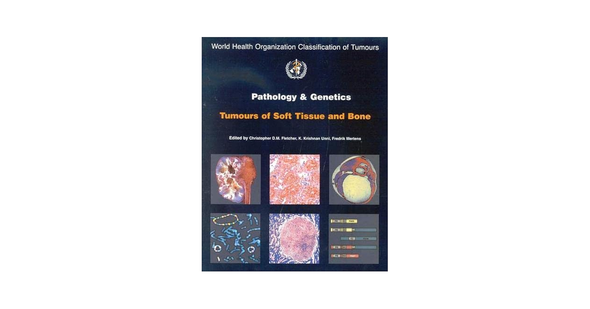 WHO Classification of Tumours of Soft Tissue and Bone (World Health Organization Classification of Tumours) Fletcher，Christopher D. M.、 Bridge，Julia A.、 Hogendoorn，Pancras C. W.; Mertens，Fredrik WHO Classification of Tumours of Soft Tissue and Bone: WHO