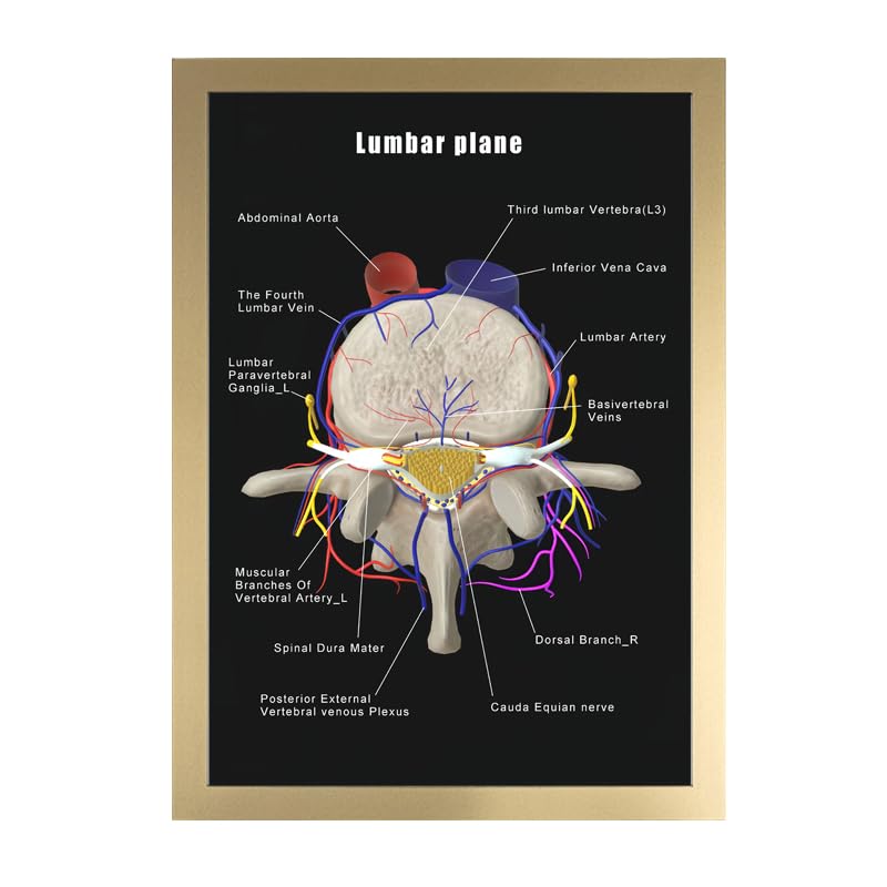 Image of Taanfu Body Educational Learning Anatomy Posters ，Lumbar Plane Art Lumbar Villi Anatomy Art Poster Digestive System Organs Illustration Small Intestine Physiology Anatomy Wall Art Villi