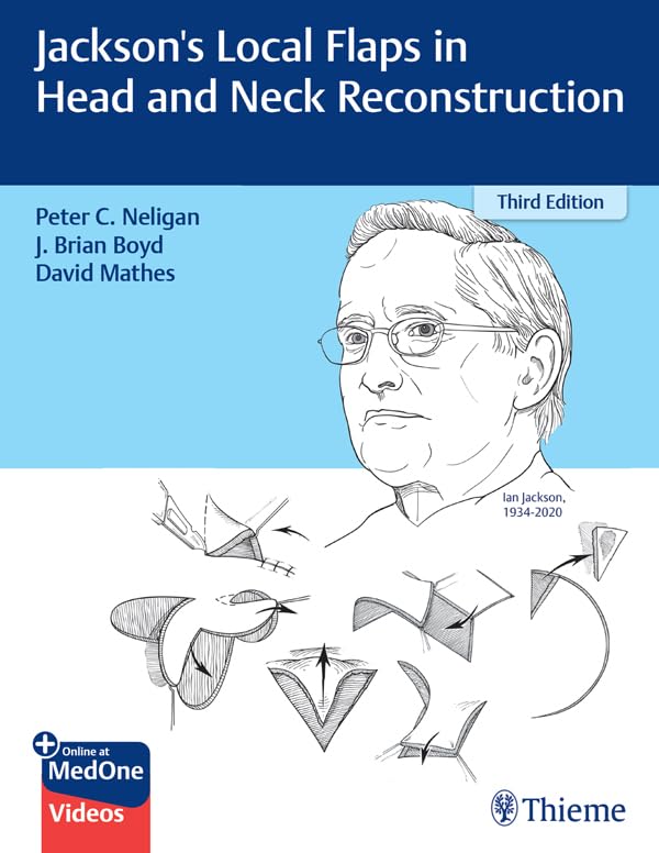 Jackson's Local Flaps in Head and Neck Reconstruction (English Edition)