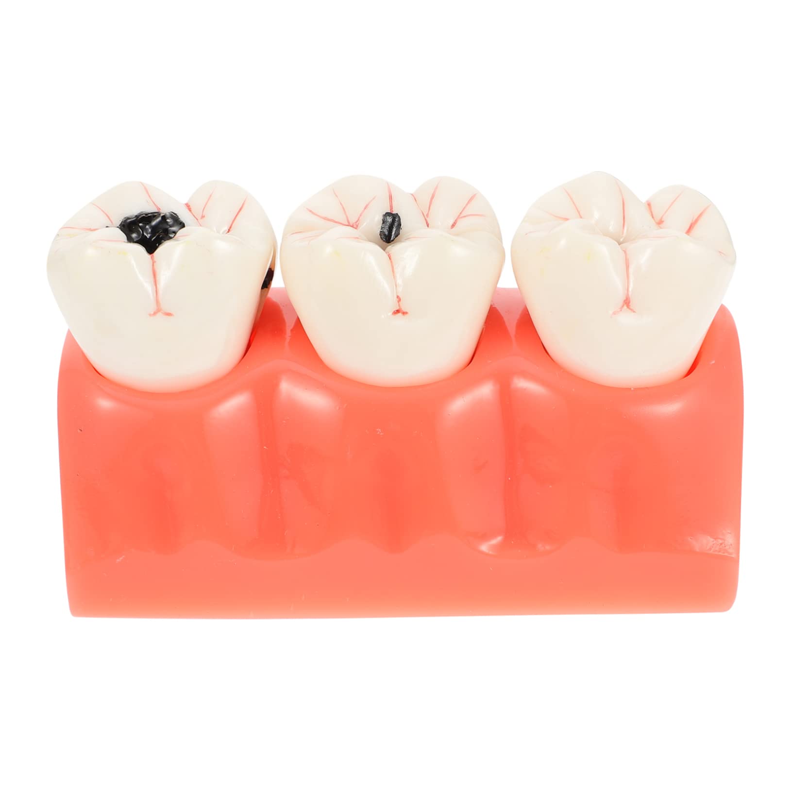 Modello Anatomico dei Denti Rosa in Resina per Insegnamento | 1 Pezzo, Superficie Liscia, Uso in Classe e Dimostrazioni, Supporto Didattico per Studio Odontoiatrico