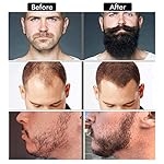 Beard Growth Kit - Beard Kit for Men, Beard Growth Oil (2oz), Beard Balm, Beard Comb, Massager for Spot/Patchy Beard - Christmas, Anniversary, Birthday Gifts for Men, Dad, Husband, Boyfriend - Image 5