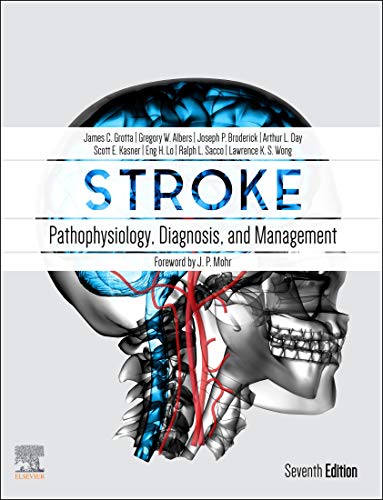 Stroke E-Book: Pathophysiology, Diagnosis, and Management (Stroke Pathophysiology Diagnosis and Mana Stroke E-Book: Pathophysiology, Diagnosis, and Management (Stroke Pathophysiology Diagnosis and Mana