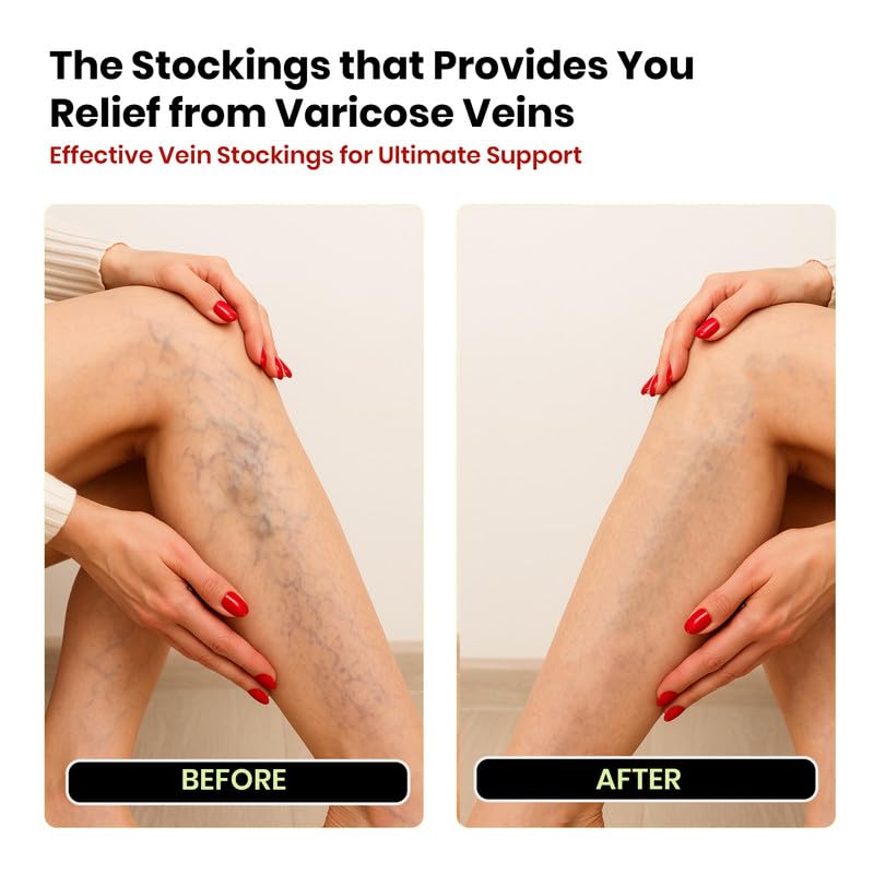 Image of Varicose Vein Stockings | Compression Stockings for Men & Women | Pain Relief & Better Circulation | Graduated Support for Leg Pain Relief & Blood Circulation | Size - L | Pack of 1