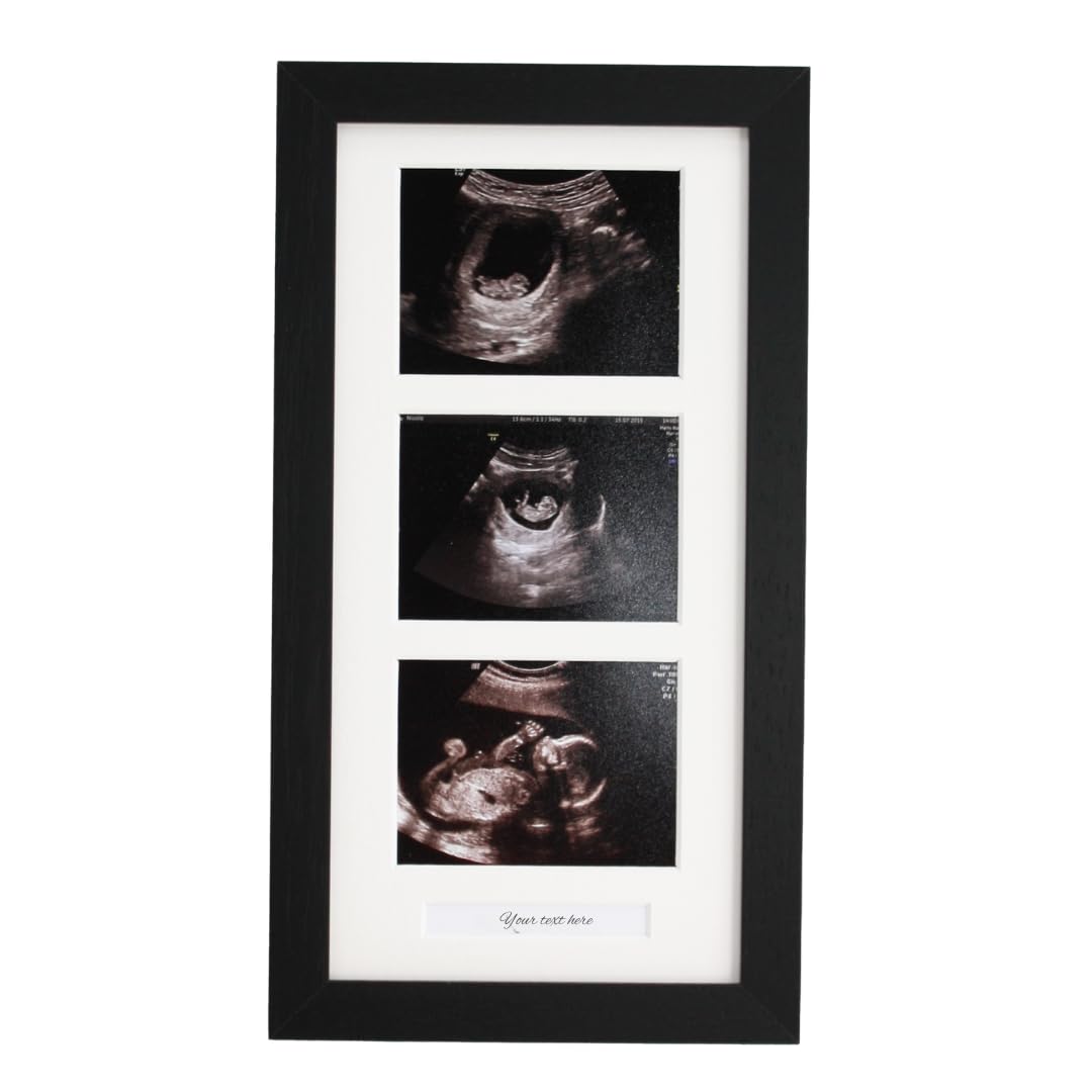 Baby Scan Photo Frame. Optional Personalisation. Multi Aperture Frame to display Three Ultra sound photographs. Pregnancy announcment | Baby Shower | Pregnancy Keepsake (Black Frame)
