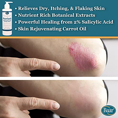 Psoriasis Medicated Scalp And Body Wash #TOP1