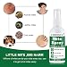 Acaros Spray,Bed Bug Killer,Anti Acaros Spray,Antiacaros Pulverizador,Bed Bug Spray,Dust Mite Spray,Spray de...
