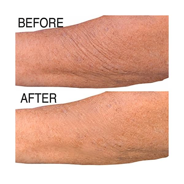 PH Factor 5.5 Clinical Retinol Moisture Cream, Anti-Aging & Skin Firming, 16 Fl Oz w/ Pump, For Face, Body & Hands, Made in USA