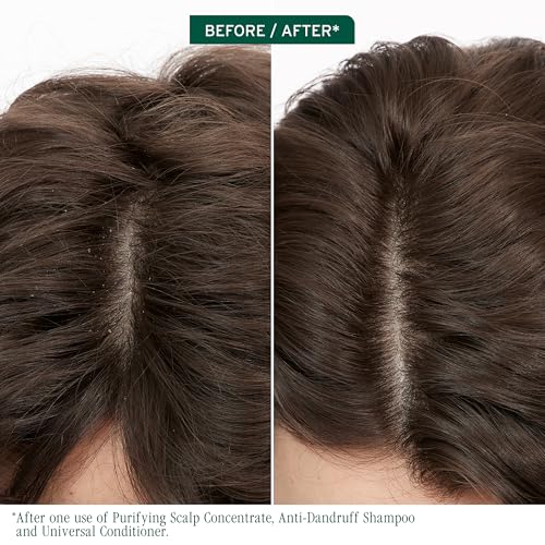 Image of Biolage Scalp Sync Anti-Dandruff Shampoo - Controls Dandruff | Controls Itchy Scalp, Cleanses Hair, Moisturizing, Dandruff Relief, For Scalp and Hair Health, Vegan & Cruelty-Free