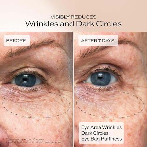Image of Shiseido Benefiance Wrinkle Smoothing Eye Cream - 15 mL - Visibly Improves Five Types of Eye Wrinkles, Dark Circles & Puffiness - 48-HR Hydration - All Skin Types - Non-Comedogenic