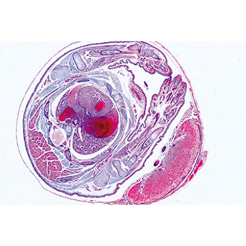 3B Scientific GmbH W13416 Genital System Micro. Slides-Set of 14, Grade: 1 to 2