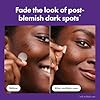 Mighty Patch Hero Cosmetics Micropoint™ for Dark Spots - Post-Blemish Dark Spot Patch with 395 Micropoints, Dermatologist Tested and Non-irritating (8 Count) #2
