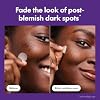 Mighty Patch Hero Cosmetics MicropointTM for Dark Spots - Post-Blemish Dark Spot Patch with 395 Micropoints, Dermatologist Tested and Non-irritating (8 Count)