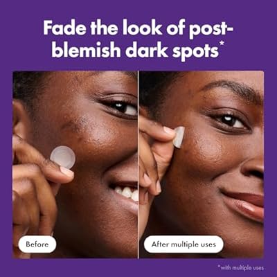 Mighty Patch Hero Cosmetics MicropointTM for Dark Spots - Post-Blemish Dark Spot Patch with 395 Micropoints, Dermatologist Tested and Non-irritating (8 Count)