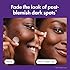 Mighty Patch Hero Cosmetics MicropointTM for Dark Spots - Post-Blemish Dark Spot Patch with 395 Micropoints, Dermatologist Tested and Non-irritating (8 Count)