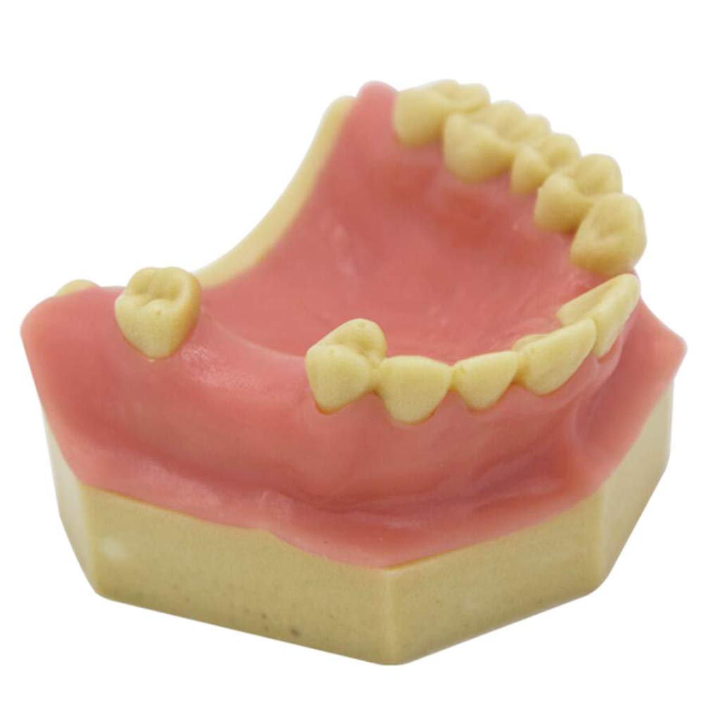 Sjdopulse Oral Implant Practice Model - Dental Teeth Model Soft Gums Demonstration Tooth Model For Patient Education Training Aid Denture Repair Planting Training