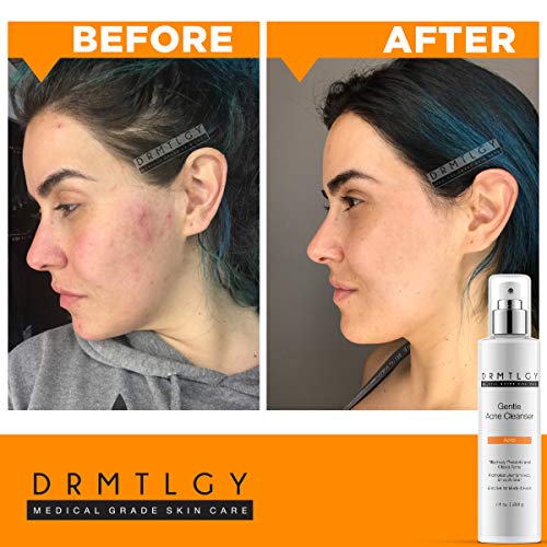 drmtlgy dark spot corrector