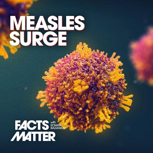 CDC Warns of Significant Measles Uptick Across US; Most Cases Recorded in 33 Years copertina