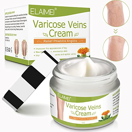 Varicose Veins Cream, Spider Varicose Vein Treatment Cream For Legs, Improve Blood Circulation, Pain and Itching of Legs Fast Relief, Anti Varicose Vein Soothing Leg Cream (1.76 OZ)