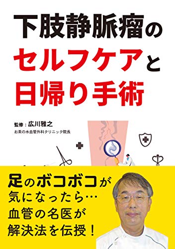 下肢静脈瘤のセルフケアと日帰り手術 下肢静脈瘤のセルフケアと日帰り手術
