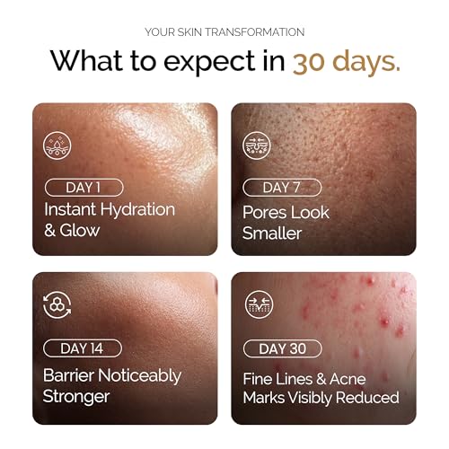 Image of Personal Touch Aquarize Hydrating Toner & Face Mist with Hyaluronic Acid & Aquaxyl | 72 Hours Hydration | Strengthens Skin Barrier | Pore Refining & Oil Balancing | All Skin Types | 100 ml