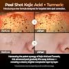 Dr. Melaxin Peel Shot Kojic Acid Turmeric Serum Exfoliating Dark Spot Corrector with AHA/BHA & Niacinamide, Brightening & Even Tone Facial Serum (80ml / 2.70 fl oz)