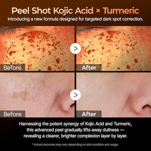 Dr. Melaxin Peel Shot Kojic Acid Turmeric Serum – Exfoliating Dark Spot Corrector with AHA/BHA & Niacinamide, Brightening & Even Tone Facial Serum (80ml / 2.70 fl oz) - Image 4