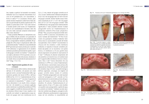 Infezione Perimplantare: Eziologia, Diagnosi E Trattamento - 3