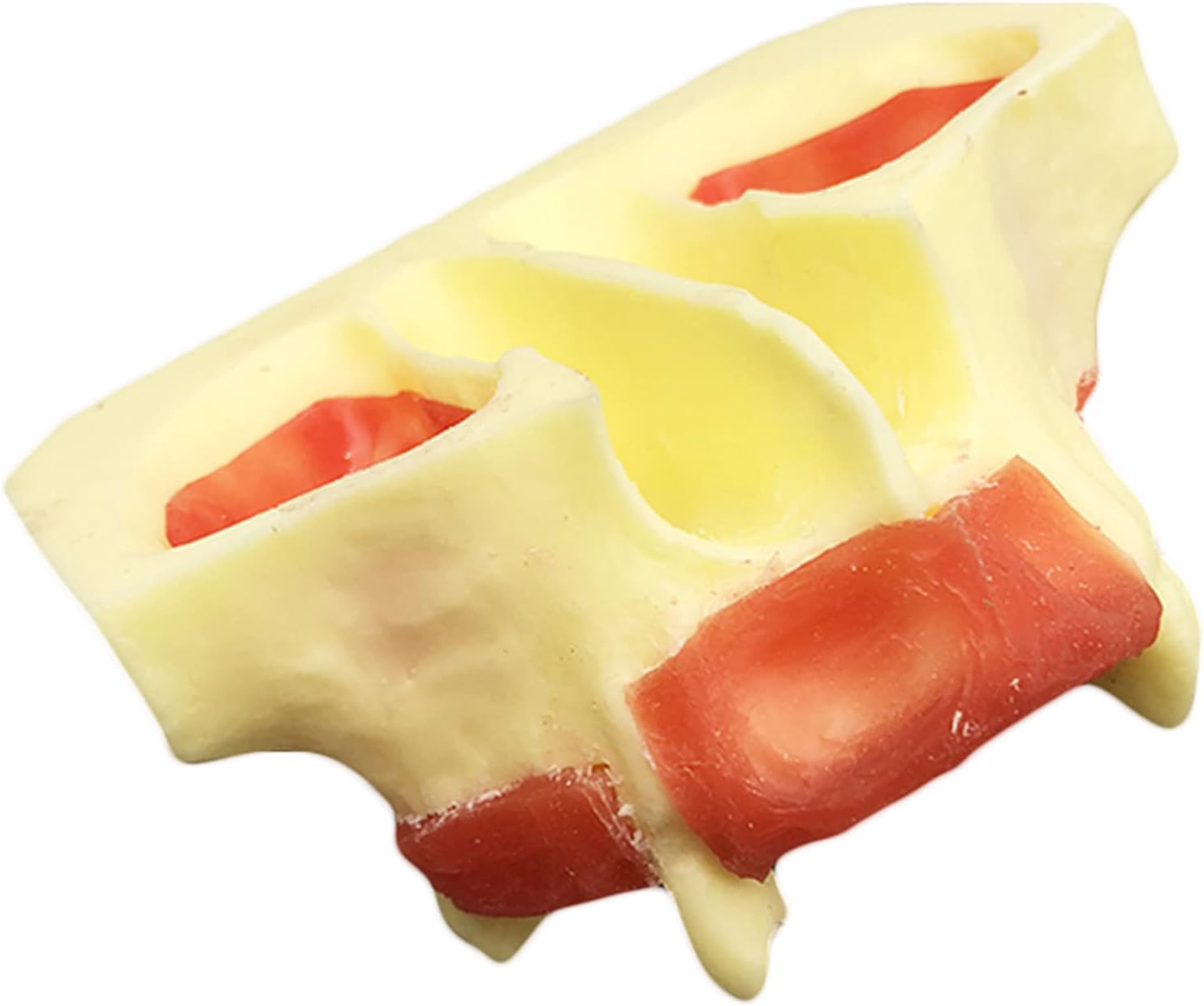 KH66ZKY Dental Implant Model Dental Maxillary Sinus Lift