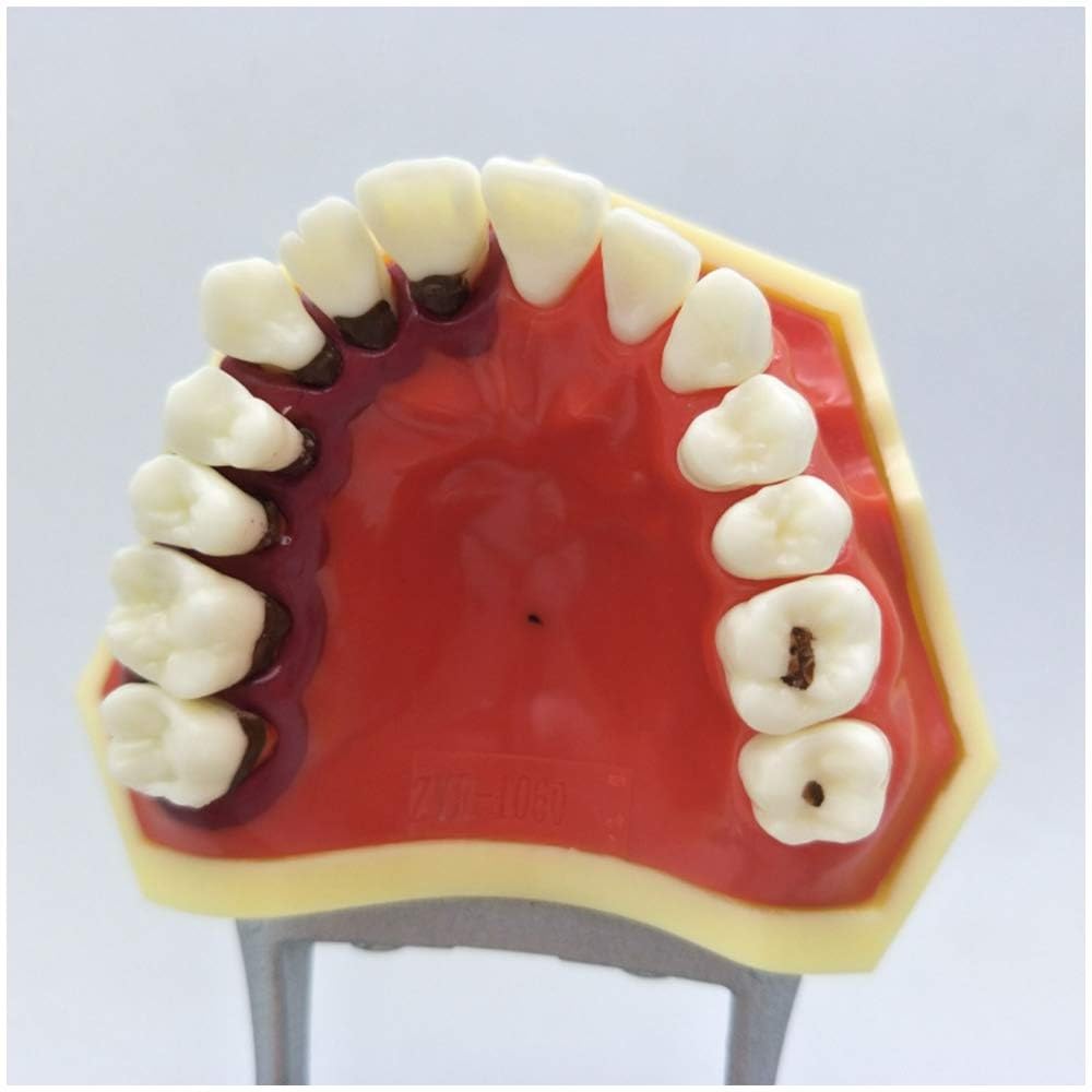 Model przyzębia zębów dentystycznych zęby jamy ustnej dziąsła ząb Typodont Implant Model do nauczania Standard badania