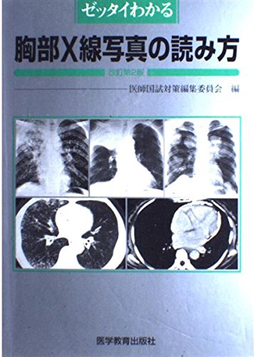 無料電子書籍 アプリ ゼッタイわかる胸部X線写真の読み方 バイ