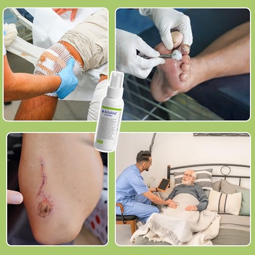 Actolind w Solution 100 ml – antiseptische Wundspüllösung. Schmerzfreie Reinigung, Spülung & Befeuchtung bei akuten, chronischen, infizierten Wunden/Verbrennungen. CE III, MPG, PHMB. PZN: 10985391
