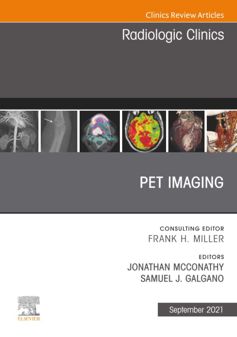 PET Imaging, An Issue of Radiologic Clinics of North America: Volume 59-5 (The Clinics: Radiology, Volume 59-5)