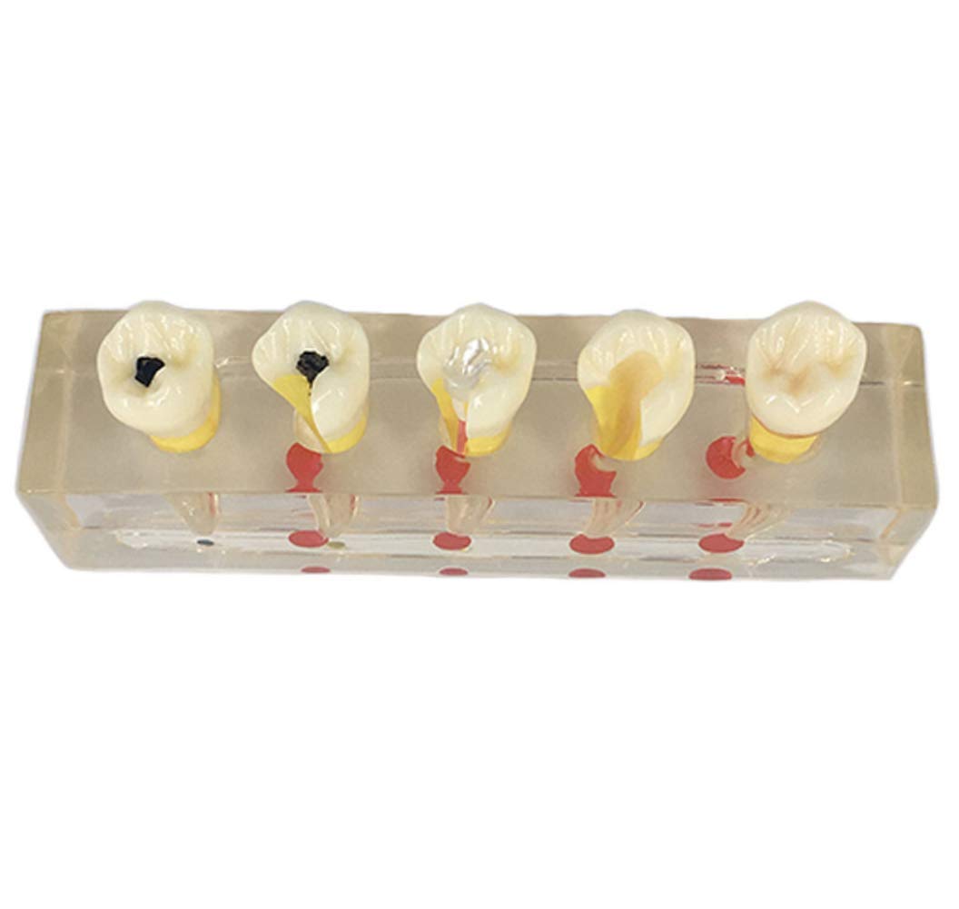 Dentiste de Formation modèle d'enseignement à communiquer avec Les Patients modèle Dentaire modèle Dentaire de la résine de démonstration Dentaire