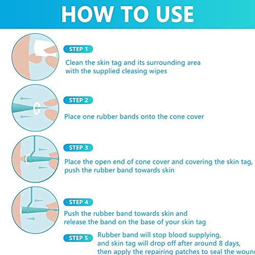 Image of Skin Tag Remover Kit (2-4mm) CONR Micro Painless DIY at Home with Cleansing Swabs Non Toxic Face Care Mole Wart Tool For Small To Medium Skin Tag (not for smaller than 2mm or flat skin tags)