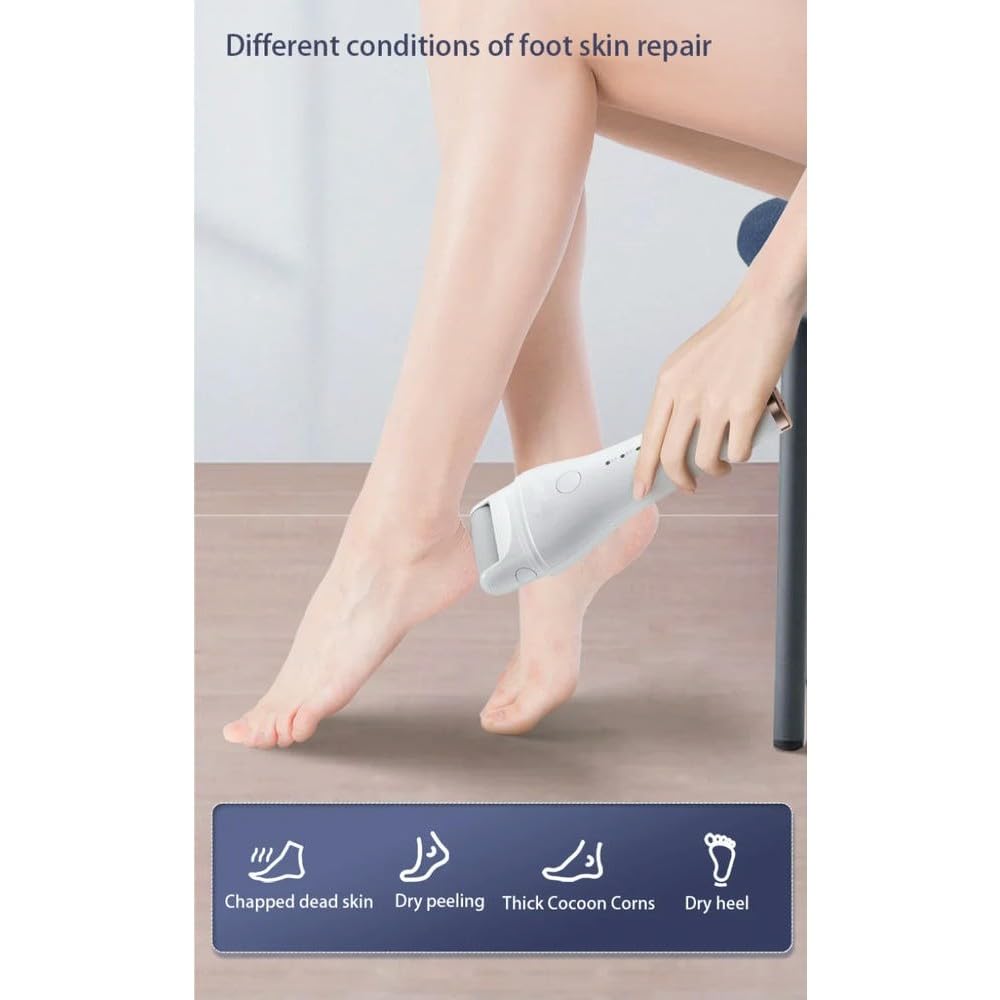 Pedicure Elettrico Lima per Piedi Dispositivo di Bellezza per Piedi Impermeabile Macchina per Pedicure Ricaricabile Rimuove la Pelle Morta e i Calli del Corpo