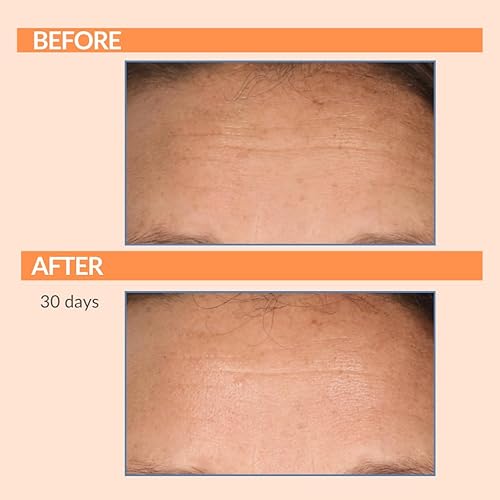 Miniatura 7 de Serious Skincare - Serious C3 Plasma Night Trio - Crema de noche C-Restore, tratamiento de belleza de ojos C y limpiador facial C Clean - Líneas