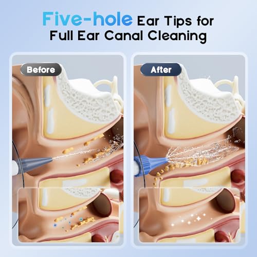 ear wax removal electric ear cleaning kit with light fsa-hsa-eligible ear irrigation kit with 4 pressure modes safe and effective ear flush kit with ear cleaner - includes basin towel amp 15 tips