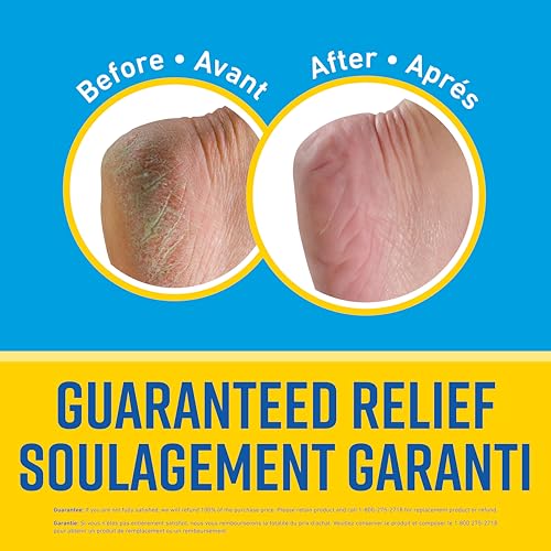 O'Keeffe's Healthy Feet Intense Renewal, Moisturizing Foot Cream, Softens Extremely Dry, Callused Feet, 3 in 1 Hydration, 3oz/85g, Tube, (Pack of 1) - Image 6