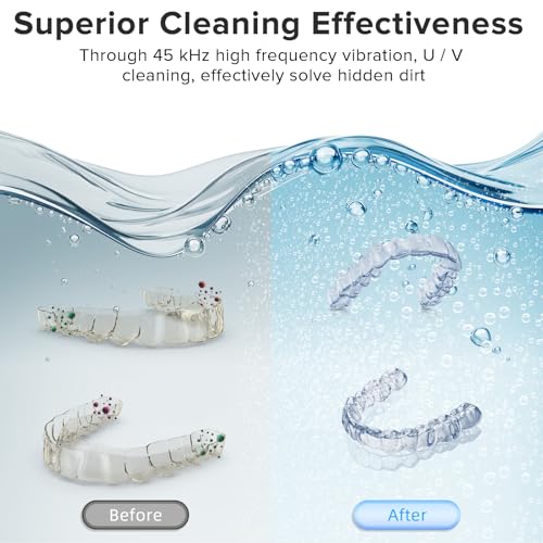Image of Ultrasonic Retainer Cleaner, 180ML /45kHz Portable Ultrasonic Jewelry Cleaner, Quiet Operation Ultrasonic Cleaner Machine for Dentures,Aligners,Mouth Guards,Night Guards (White)