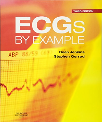 ECGs by Example view 2